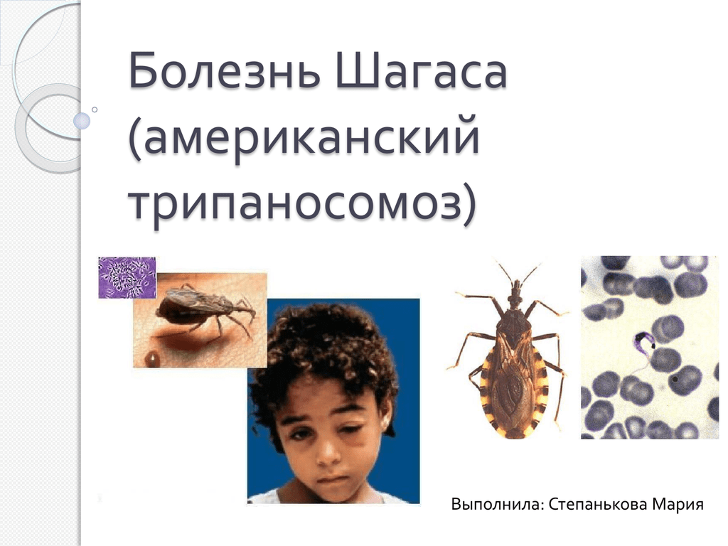 Признаки ам. Возбудитель болезни Чагаса (Trypanosoma cruzi). Американский трипаносомоз болезнь Шагаса. Болезнь Шагаса профилактика. Переносчики возбудителя американского трипаносомоза.