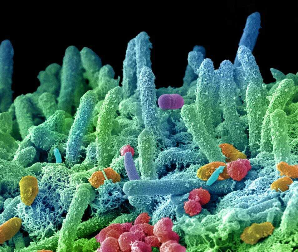 Планета бактерий